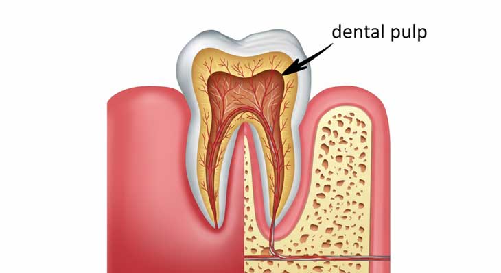 پالپ دندان چیست؟
