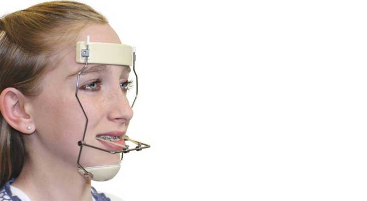 فیس ماسک ارتودنسی چیست؟