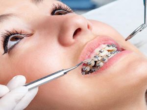مشکلات رایج ارتودنسی