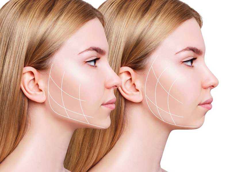 جراحی فک ارتوگناتیک