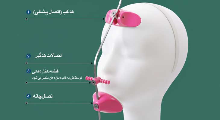 فیس ماسک ارتودنسی چیست؟