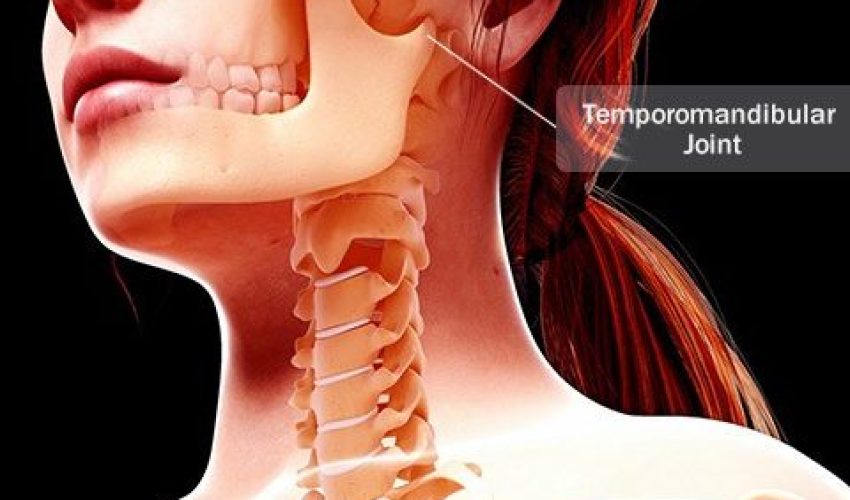 اختلال مفصل گیجگاهی-فکی