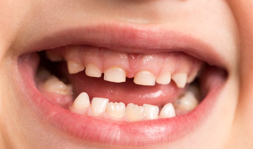 اهمیت دندان های شیری