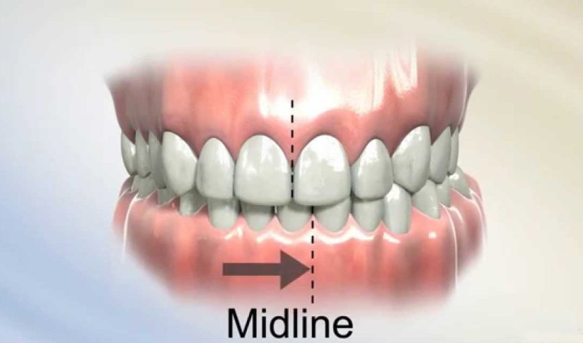 کراس بایت