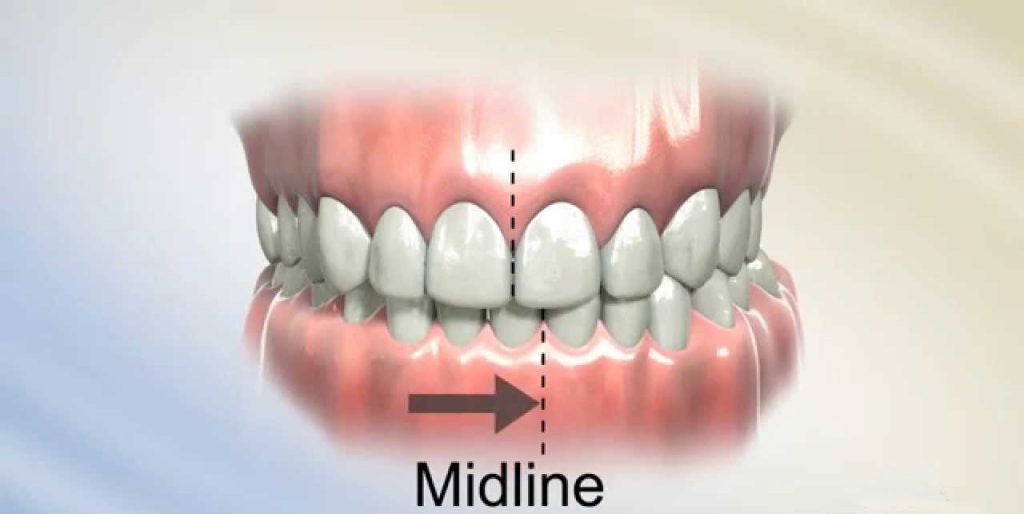 کراس بایت