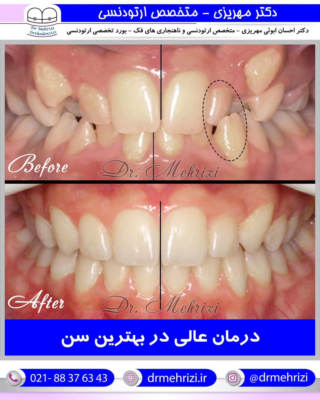 درمان ارتودنسی