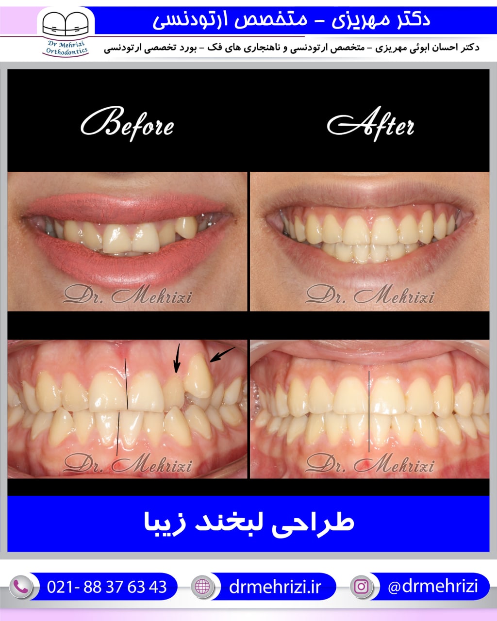 طراحی لبخند